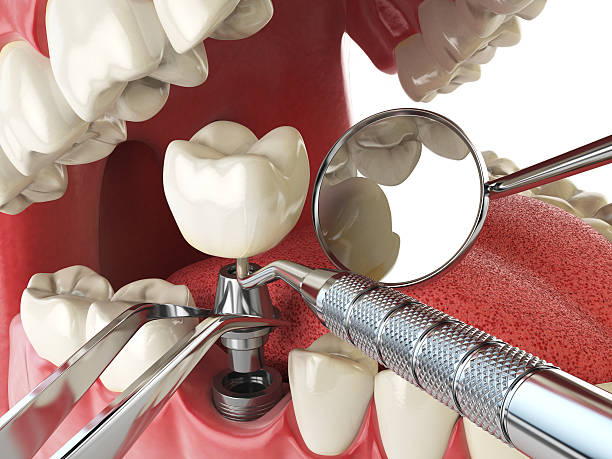 Best Emergency Root Canal Therapy in Trion, GA